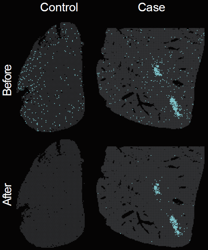 Spatial distribution of pathogen-derived background signal before and after background correction.